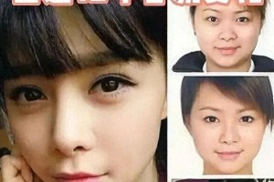 金晨整容后遗症引热议：鼻子嘴巴歪斜引关注